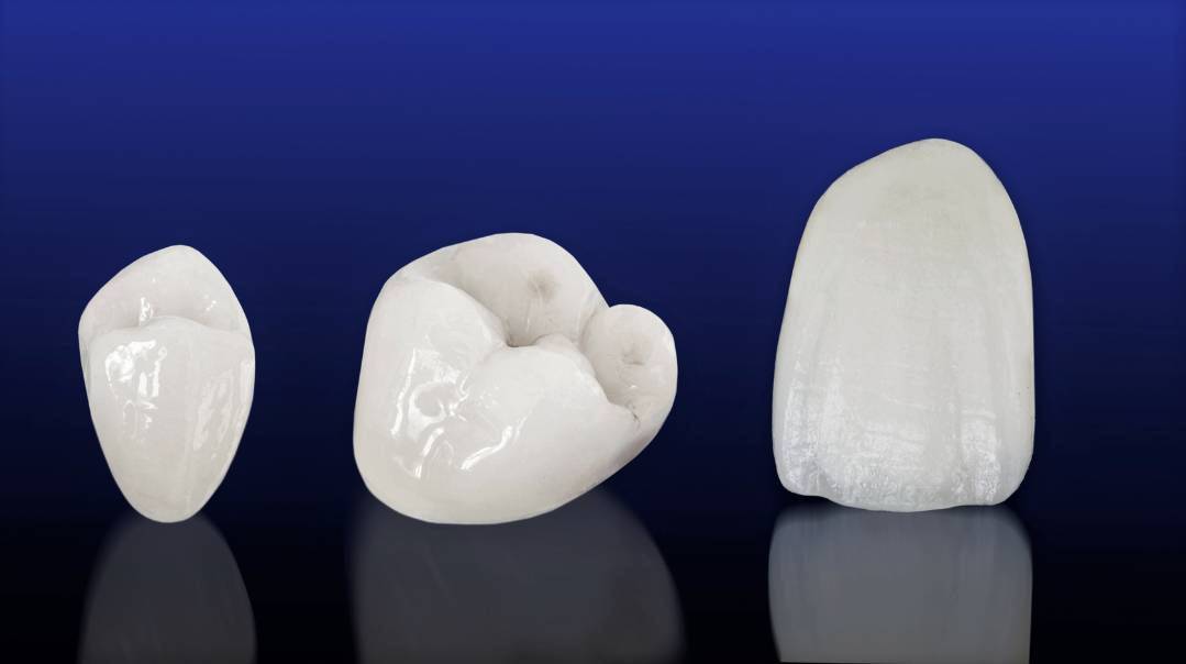 Metal porcelain crown & full veneer Turkey Medica Smile