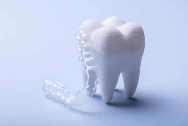 What is a gum shield? MedicaSmile