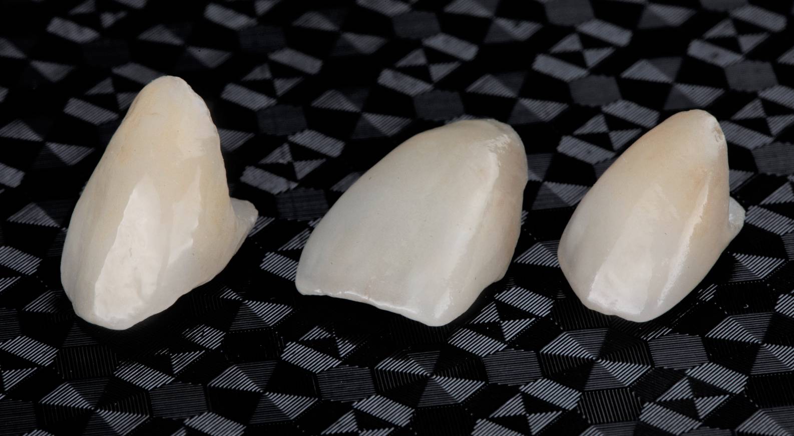 The best place to get veneers Turkey