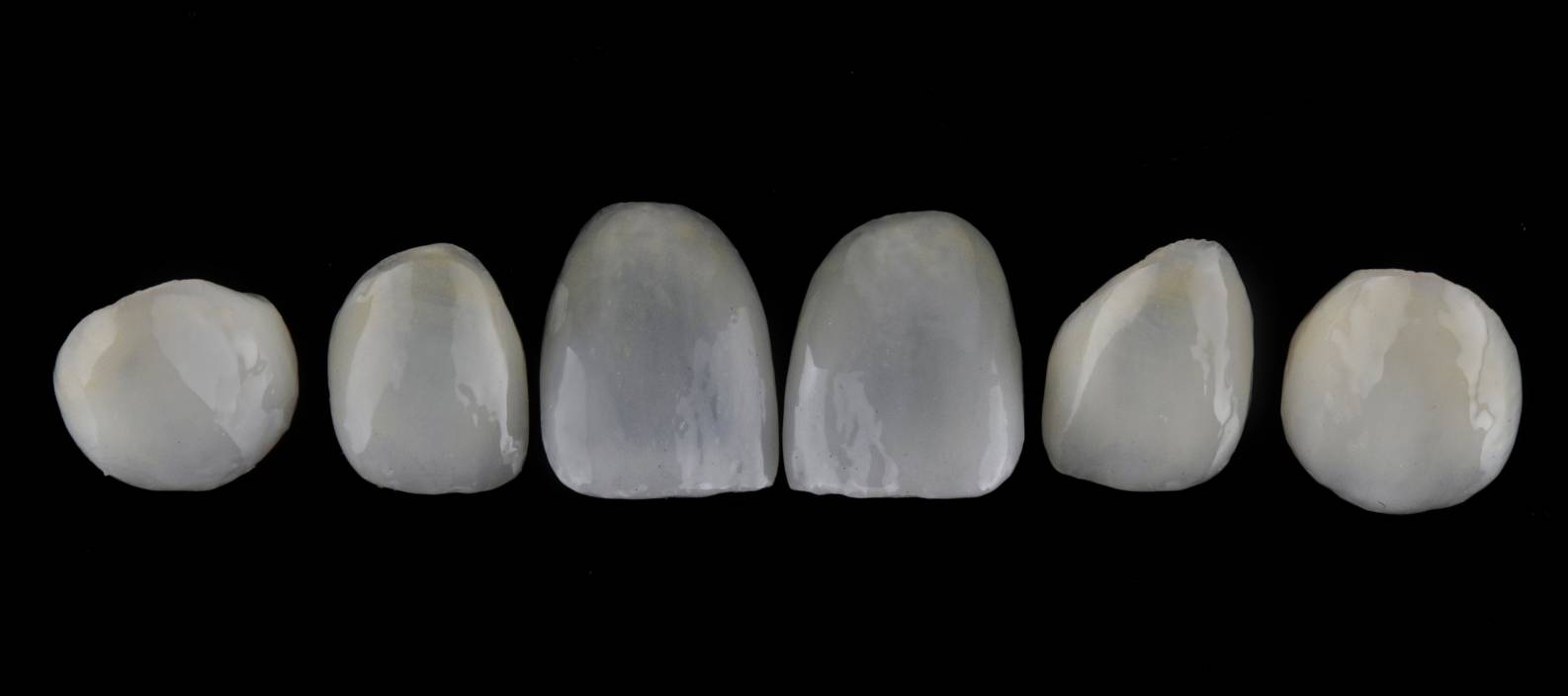 The best place to get veneers Turkey