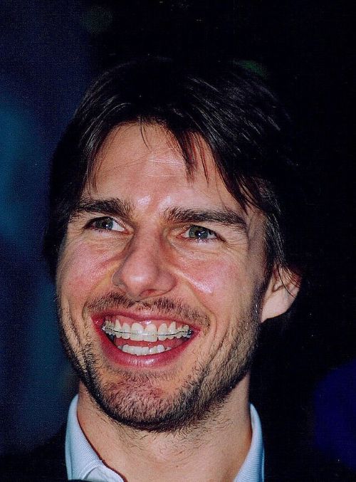 Tom Cruise Teeth Before Dental Work