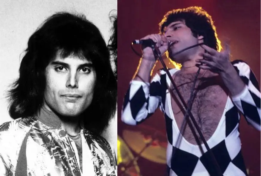 Why Freddie Mercury Didn't Treat His teeth